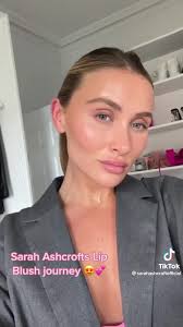 Repost from @Sarah Ashcroft 😍 We LOVED having Sarah back in the clinic for  her Gloss & Go Lip Blush