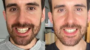 Cancer mum Karla loses fight for life