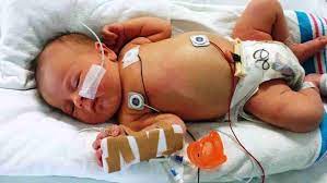 Tetapi bunda tetap perlu waspada, terutama jika napas bayi berbunyi disertai sesak napas, batuk, demam, dan bayi tampak. Anak Bernafas Laju Nak Bawa Pergi Mana Kecemasan Dekat Hospital Atau Klinik Kesihatan Dulu Mak Ayah Wajib Baca Semua Semua Semuanya