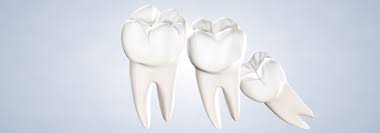 Maybe you would like to learn more about one of these? Wisdom Teeth Removal At Oral Surgery Group In East Brunswick Nj