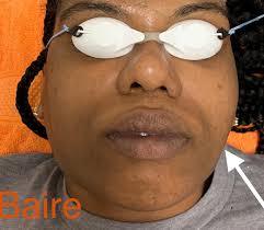 BAIRE-Hair Removal, Lashes,Brows,Facials