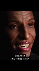 Is Elsie Albert Trans Change