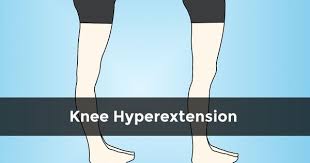 Fixing Hyperextended Knee Posture Somastruct Knee Exercises Exercise Postures