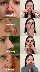How to Get a Thinner Nose