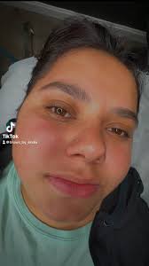 She wanted a color added to her lips❤️ cherry red by permablend delivered  the clients request #lipblushtattoo #brows_by_sindia #microblading  #powderbrows #permanentmakeup #cosmetictattoo #johnstonRI ...