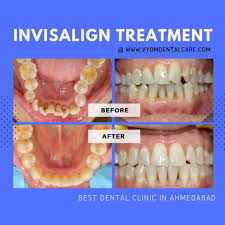 Simply click 'find an nhs dentist near me'. Dental Clinic In Ahmedabad Orthodontist Cosmetic Dentist In Ahmedabad