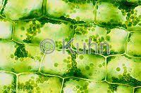 Plant cells are enclosed by rigid cell walls. Px09 006a Elodea Plant Live Cells With Chloroplasts Hypotonic Solution Anacharis Spp 400x Compare Px09 006a Px09 0 Plant Cell Plant Cell Images Plants