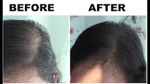 Oribe's iconic spray is packed with polymers that absorb oil at the roots, while adding. Will It Cover Up My Thin Hair Batiste Dry Shampoo First Impression Youtube