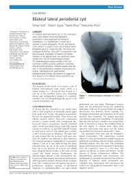 Pdf Bilateral Lateral Periodontal Cyst