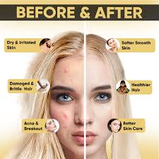 Shower Filter for Hard Water