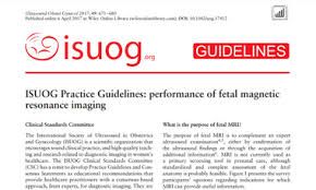 Image result for Fetal Testing Indications