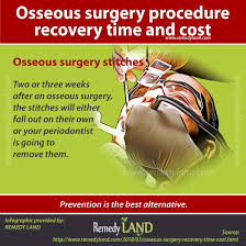 Osseous Surgery Procedure Recovery Time And Cost Remedy Land