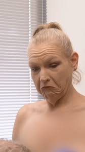 Vanessa reveals her loose skin after losing 250lbs+ through weight-loss  surgery 🥺 #1000LbBestfriends