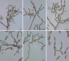 Image result for Kyphocarpa angustifolia