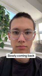 Going Bald to Grow New Hair Men