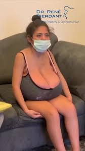 Gigantomastia - ThisVid.com