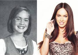 Take a look at celebrities with braces before and after. 8 Celebrities Who Had Braces Wilkinson Orthodontics