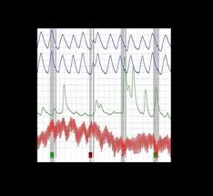 This is available to use for free for both android and ios users. New York The Polygraph Guy
