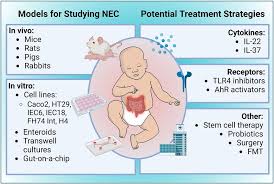Image result for Necrotizing Enterocolitis