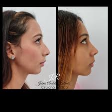 Jaime Andres Robledo Ramirez (@drjaimeandresrobledo) • Instagram photos and  videos