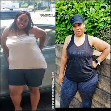 Pin On Before And After Weight Loss Stories