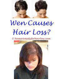 I have no other hair loss on my body, just my head. Pin On Treat Hairloss