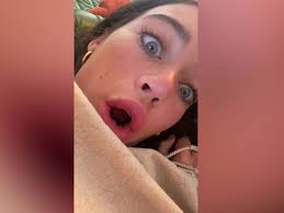 Influencer Olivia Neill responds to trolls blaming her skin cancer