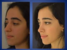 Istanbul aesthetics plastic surgery center is a turkish clinic specialized in aesthetic, plastic and dental procedures, hair transplant, and brazilian butt . Istanbul Aesthetic Plastic Surgery Center In Turkey 121 Reviews Prices For Treatment Bookimed