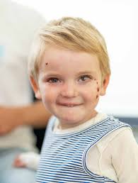 Jahresbericht 2020 DEBRA Austria