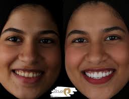 𝑫𝒓.𝑵𝒂𝒅𝒂 𝑩𝒂𝒅𝒓