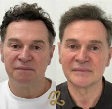 EQUIPO COOLSCULPTING ZARAGOZA Os presentamos a la Dra.Carmen Fernández.  Ella, junto a un gran equipo profesional, está al frente de la Unidad de  Coolsculpting. Único tratamiento médico que logra eliminar la grasa