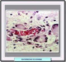 We did not find results for: Atlas De Neurologia