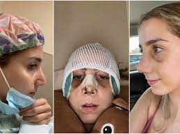 0 (0 votes) rate now : Tiktok Plastic Surgery Aggressively Promoted To Teenagers