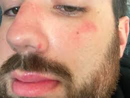 Steve ODell（@sodellicious）• Instagram 相片與影片