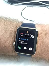 Hey since watchos 6 came out i didn't see the noise app can anyone know any noise apps for my series 3? Anybody Getting Paranoid About Their Watch Battery Expanding In Their Apple Watch This Is My Second Series 0 Watch That I Ve Had For 2 5 Years As The First Had The Screen Pop