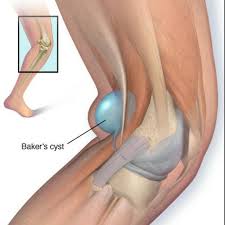 Pin En Musculos