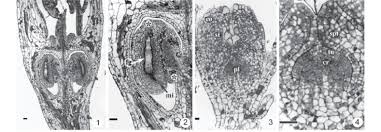 Image result for Otiophora lebruniana
