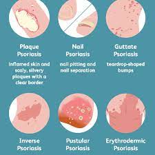 See more ideas about psoriasis diet, psoriasis remedies, treat psoriasis. Psoriasis Symptoms And Complications