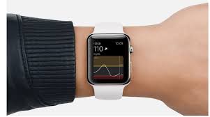 Dexcom And Apple Watch Are Here And They Bring Ipad Support Apple Watch New Apple Watch Apple Watch Apps