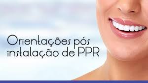 Orientações pós instalação de PPR - Integra Odontologia | Clínica  Odontológica em Bertioga