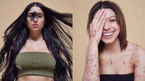 6 Wanita Unik Ini Buktikan Cantik Tak Melulu Harus Putih Dan Langsing Tribunnews Com Mobile