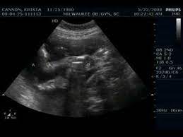 The Twins 28 Week Ultrasound Youtube
