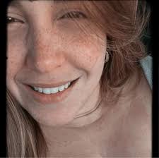 HAPPENING NOW: Twenty people are without homes this morning after a  massive, smoky fire ripped through a handful of multi-family buildings in  Lawrence last night.