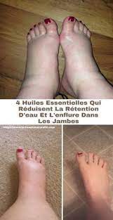 Le sodium et par exemple, si vous mangez une pizza 4 fromages, il est normal d'être tout gonflé le lendemain. Pin On Circulation Du Sang