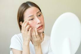Vì sao da mặt bị ngứa và cách khắc phục đơn giản