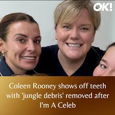 She's shown off her new teeth! (link in comments)