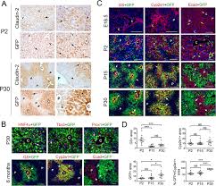 Jun 27, 2016 · study assessments included body and liver/kidney weight, liver function test, liver/kidney morphology and collagen deposition, fibrogenic gene and protein expression, and pharmacokinetic analyses. Metabolic And Non Metabolic Liver Zonation Is Established Non Synchronously And Requires Sinusoidal Wnts Elife