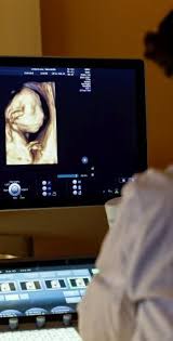 Zusätzlich zu deutsche mark um die feindiagnostik erweiterten. Pranatale Diagnostik Im 2 Und 3 Trimester