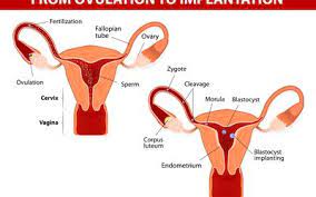Studies done at boston children's hospital have shown that if endometriosis is found in girls and treated early, it does not tend to get worse over time. Endometrium Conditions And Diseases