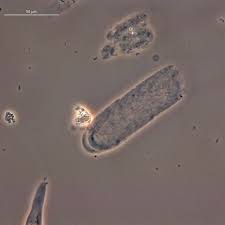 Hyaline Cast Phase Contrast X400 Urinarysediment Urine Nephrology Nephpearls Medical Laboratory Medical Laboratory Scientist Medical Laboratory Science